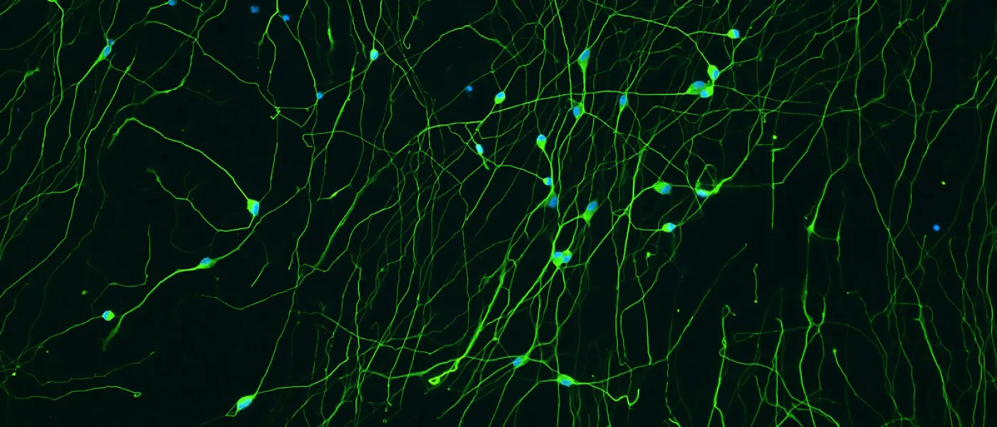 A network of long cells under a microscope