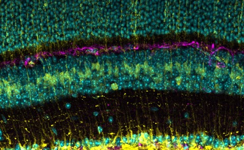 A microscope image of a mouse retina