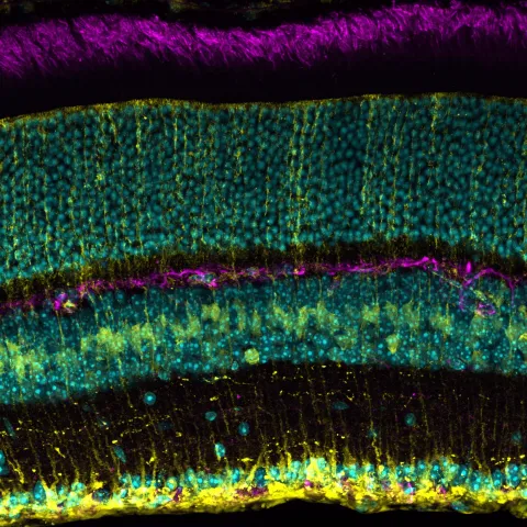 A microscope image of a mouse retina